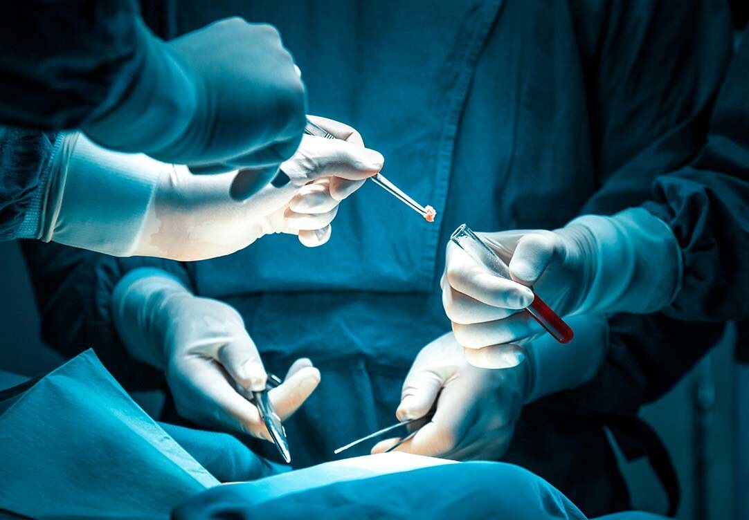 Cirurgia Oncológica
